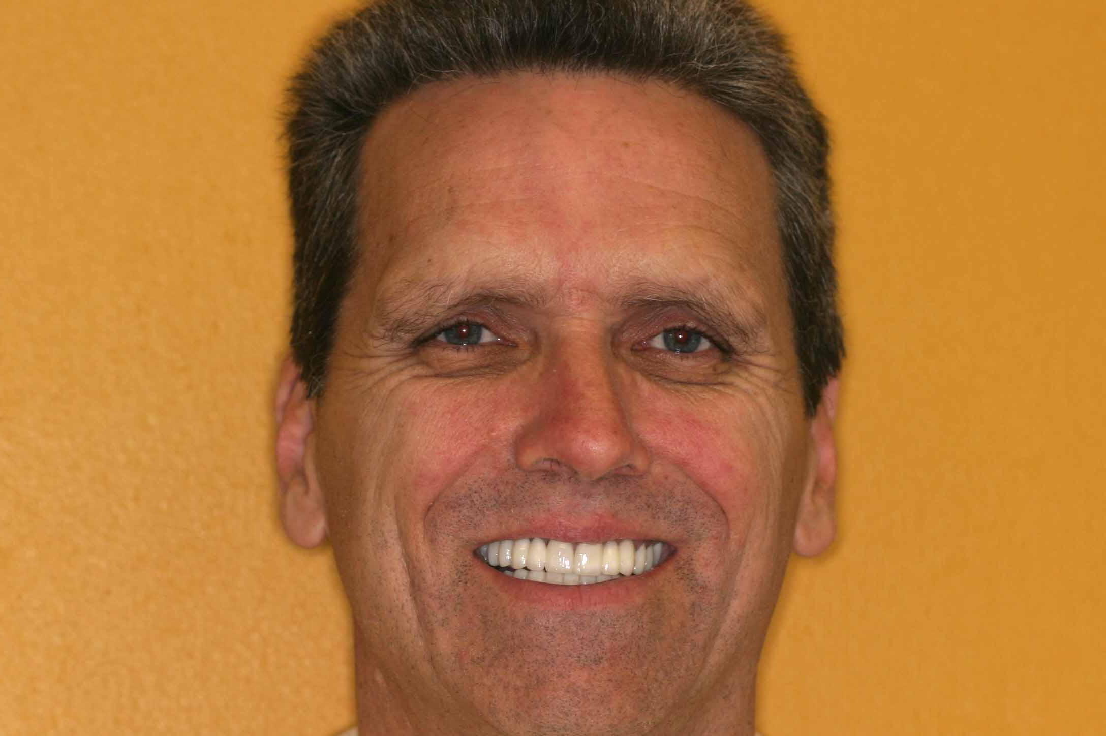 Cosmetic Dentist Fort Myers Cape Coral Naples FL